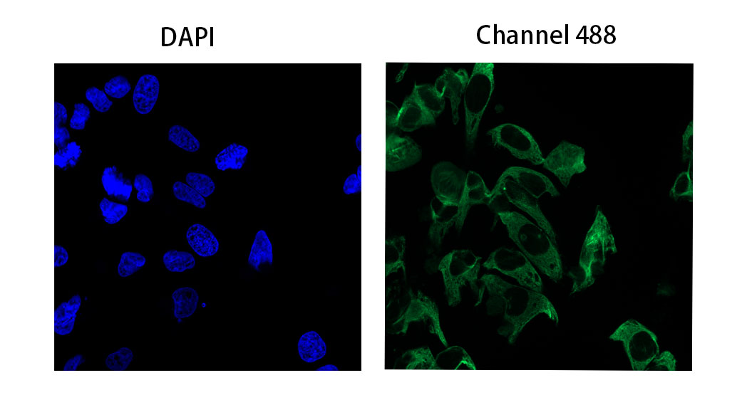 IF experiment of Hela using Anti-Mouse IgG(H+L), AlpSdAbs® VHH(iFluor488 ×8)